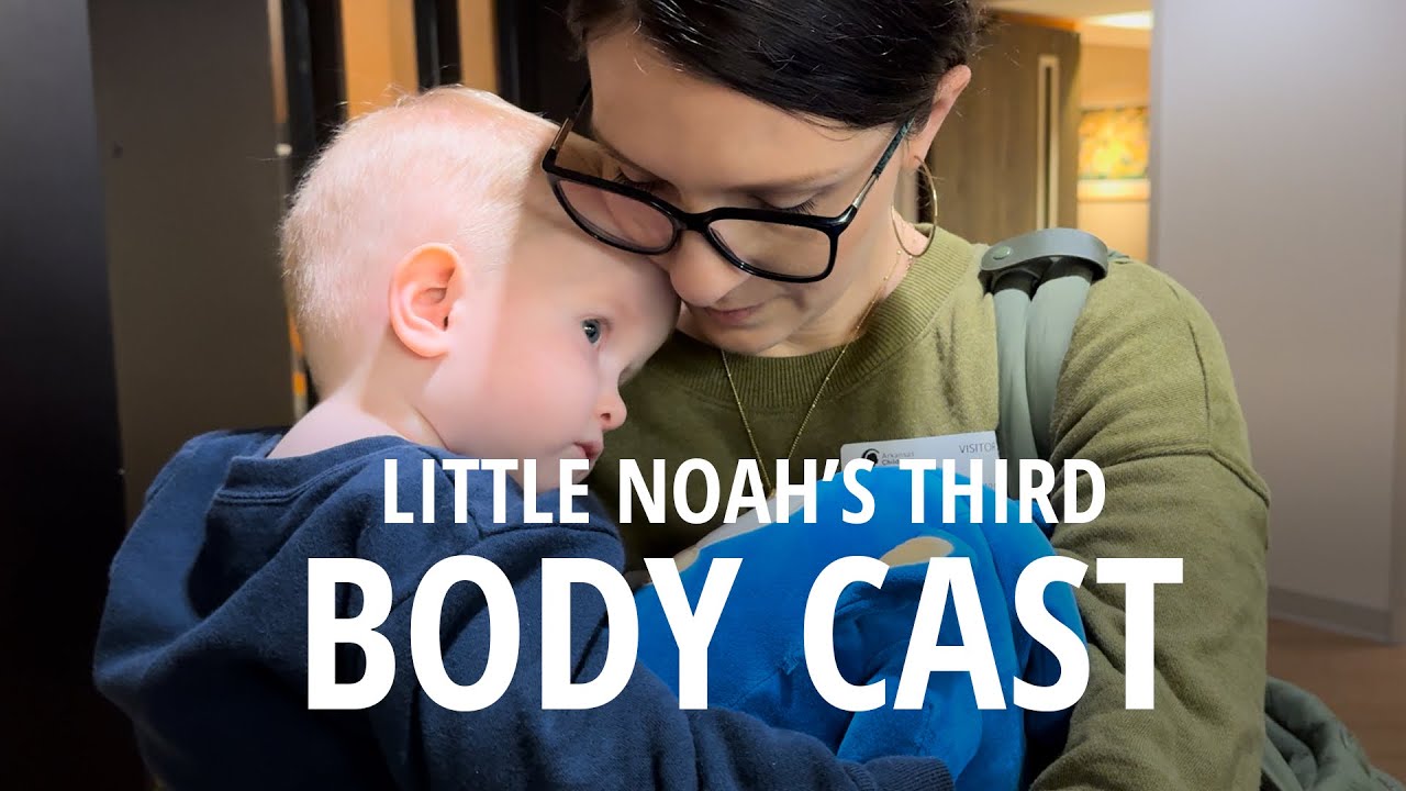 YOUNGEST OF 11 BROTHERS PREPARES FOR THIRD BOSY CAST: SCOLIOSIS