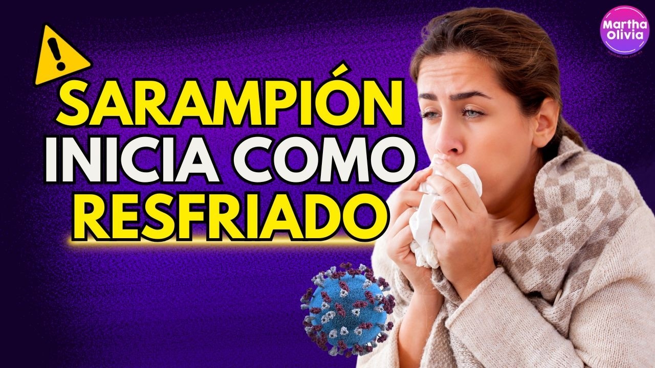 Sarampión en México: quiénes deben vacunarse y quiénes no