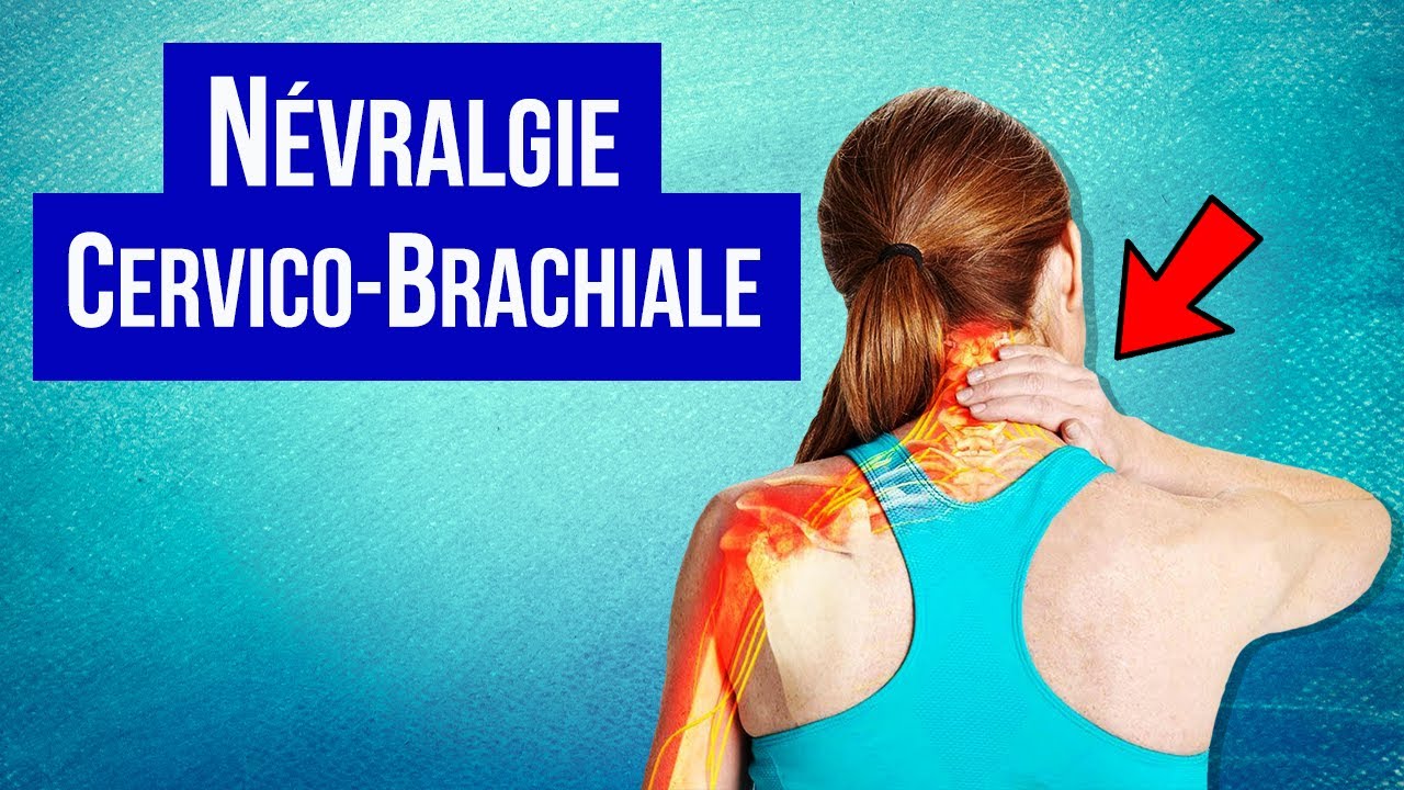 Névralgie cervico-brachiale : Symptôme et Traitement