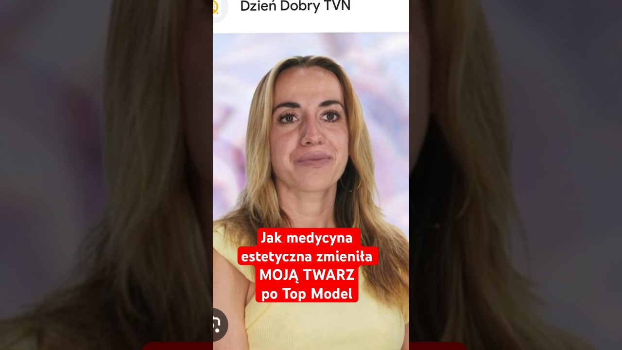 Jak zmieniła się moja twarz w 2 lata po Top Model. #mariannaschreiber #medycynaestetyczna