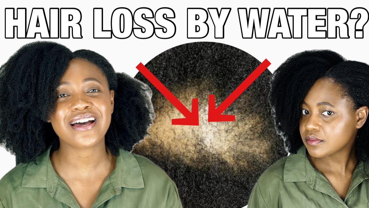 Is HARD WATER causing your HAIR LOSS? How to manage hard water