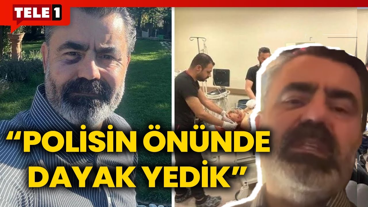 MHP'liler kumpas mı kurdu? Kayseri'de saldırıya uğrayan Avukat Emre Ayan anlatıyor