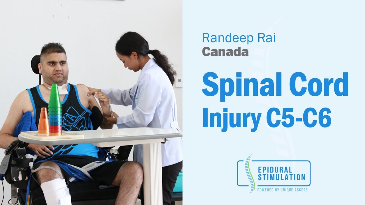Canadian C5-C6 Spinal Cord Injury Patient Randeep's Road to Recovery After Epidural Stimulation