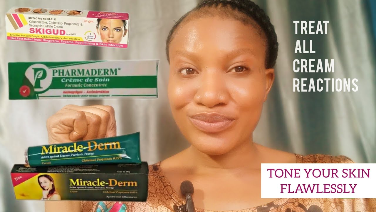 3 Anti Reaction Creams that will get rid of all your cream reactions,skin irritation and infections