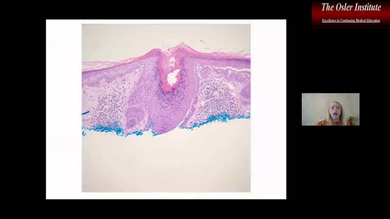 Osler Anatomic Pathology Online Review 2020 Sample