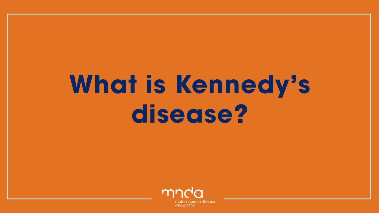 Che cos'&egrave; la malattia di Kennedy?