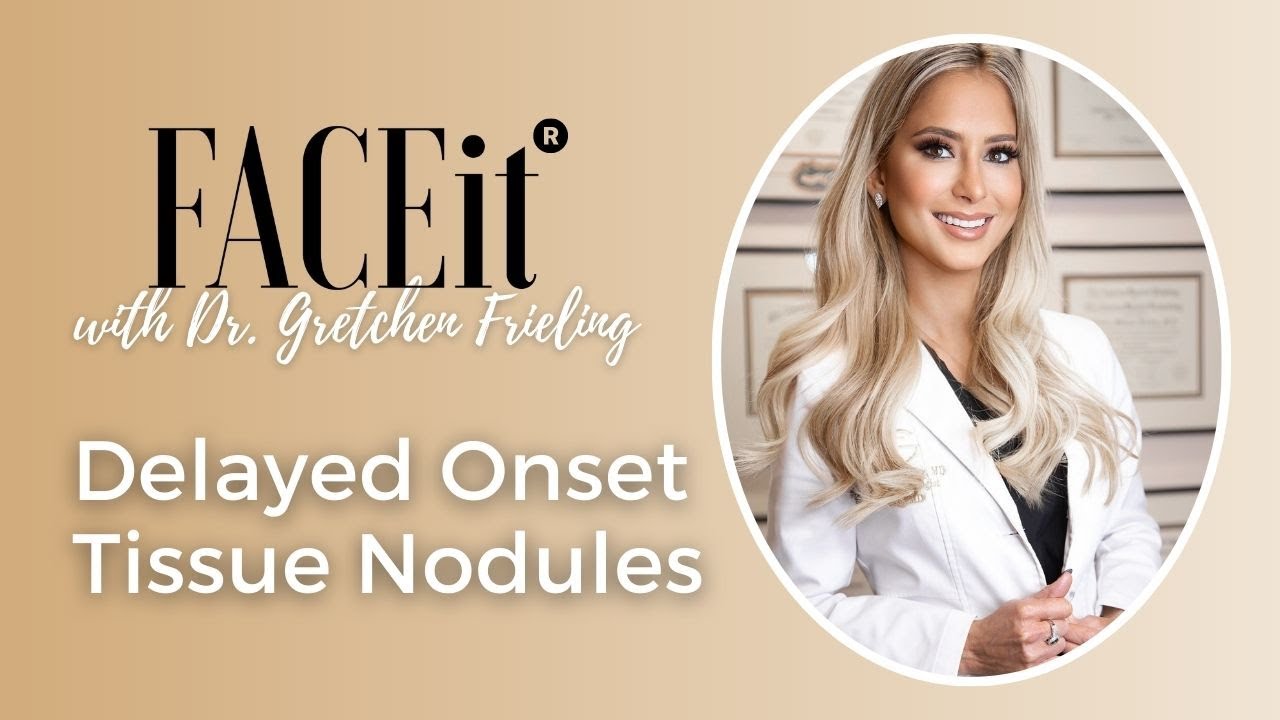 FACEit with Dr. G: Delayed Onset Tissue Nodules