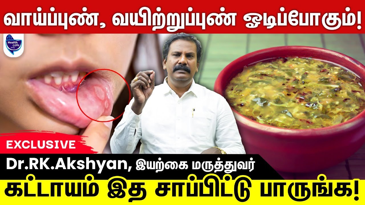 வாய்ப்புண், வயிற்றுப்புண்-க்கு அருமையான வீட்டுக்குறிப்பு ! | Ulcer Remedy