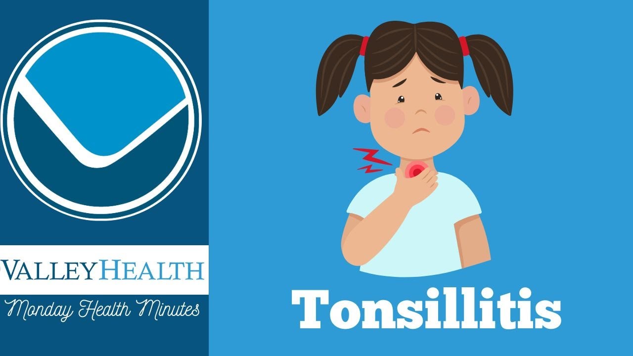 Tonsillitis | Monday Health Minutes with Valley Health