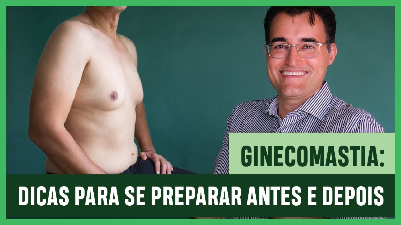 GINECOMASTIA: DICAS Para Se PREPARAR ANTES E DEPOIS Da CIRURGIA! #2
