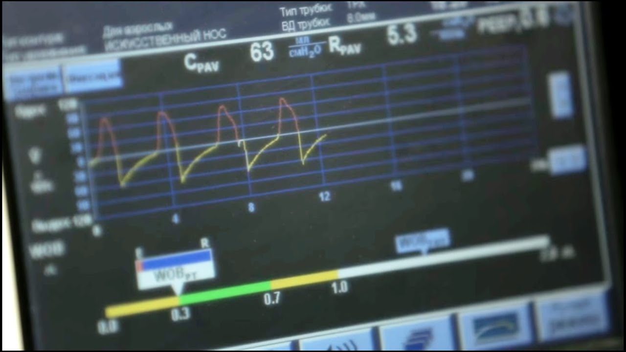 Искусственная вентиляция легких