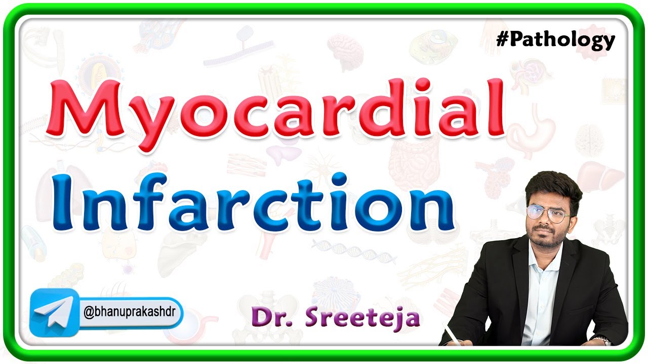4: Myocardial Infarction (Heart Attack) | Pathology USMLE Step 1