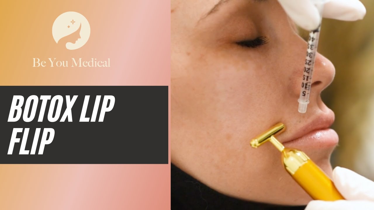 Botox Lip Flip