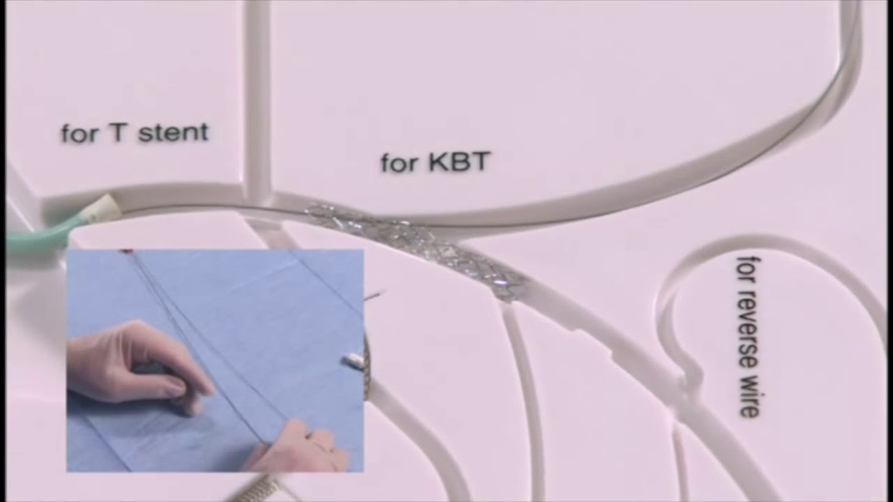 Angioplasty technique: Culotte stent (+English subtitle)
