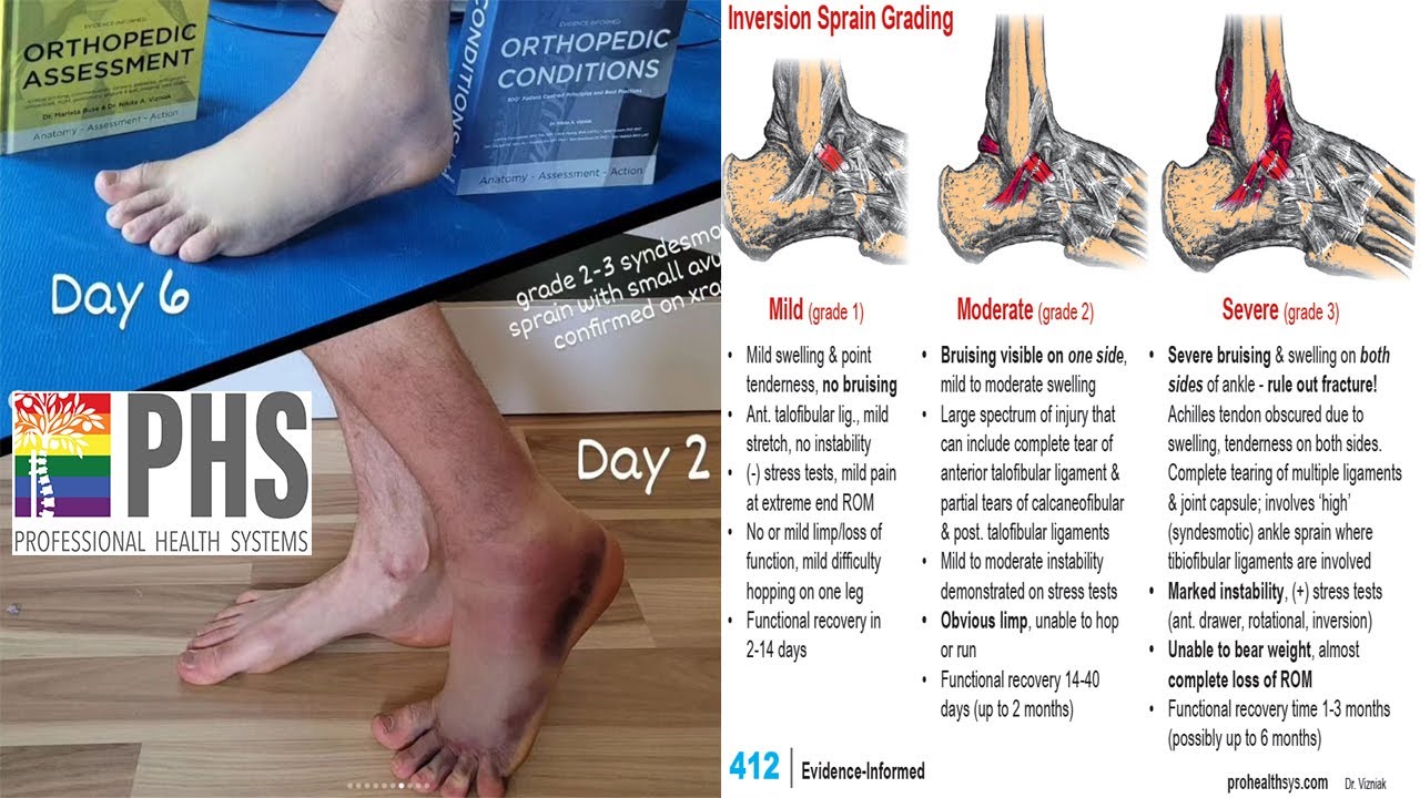 Ankle Treatment Best Practices Dr Nikita Vizniak