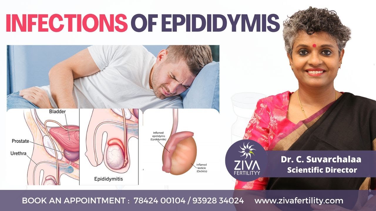 Infections Of Epididymis || Male Infertility || Dr C Suvarchalaa || ZIVA Fertilityy