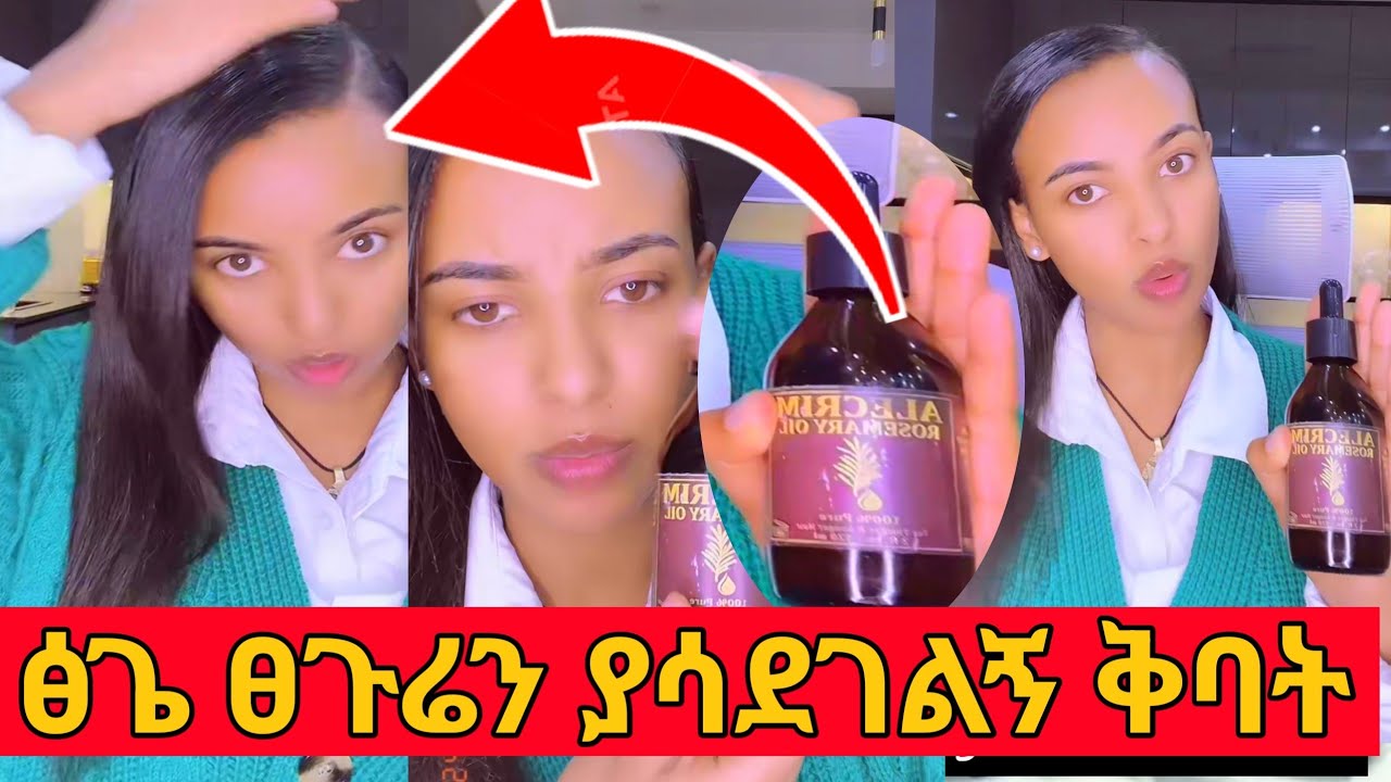 ፅጌ ፀጉሬን በፍጥነት ያሳደገልኝ ቅባት