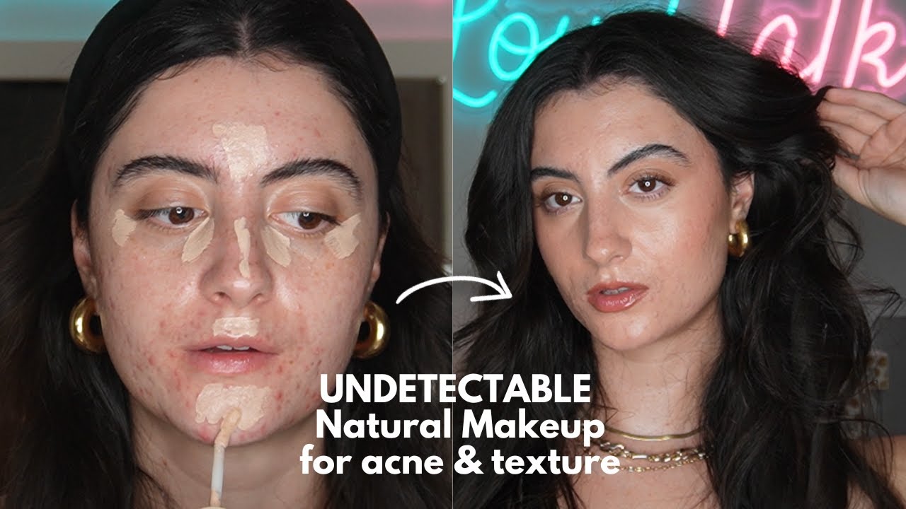 UNDETECTABLE NO MAKEUP MAKEUP ON ACNE | How to Become More Comfortable Wearing Less Makeup