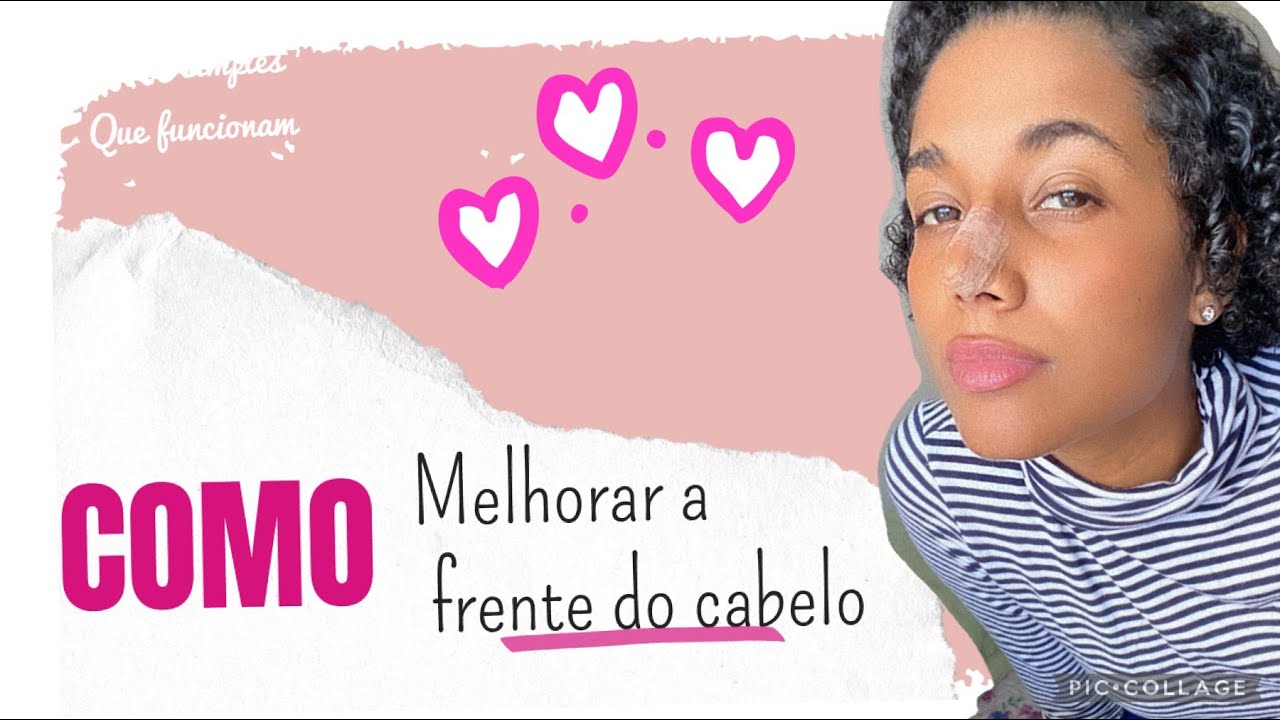 Como melhorar a frente do cabelo! Dicas simples que funcionam! O fim do scab !Leia a descri&ccedil;&atilde;o!