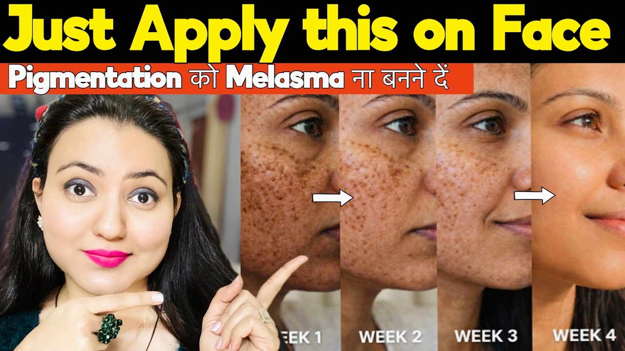 सिर्फ 7 दिन में कितनी भी पुरानी झाइयां, काले दाग धब्बे 100% जड़ से खत्म करें | Preity Prerna