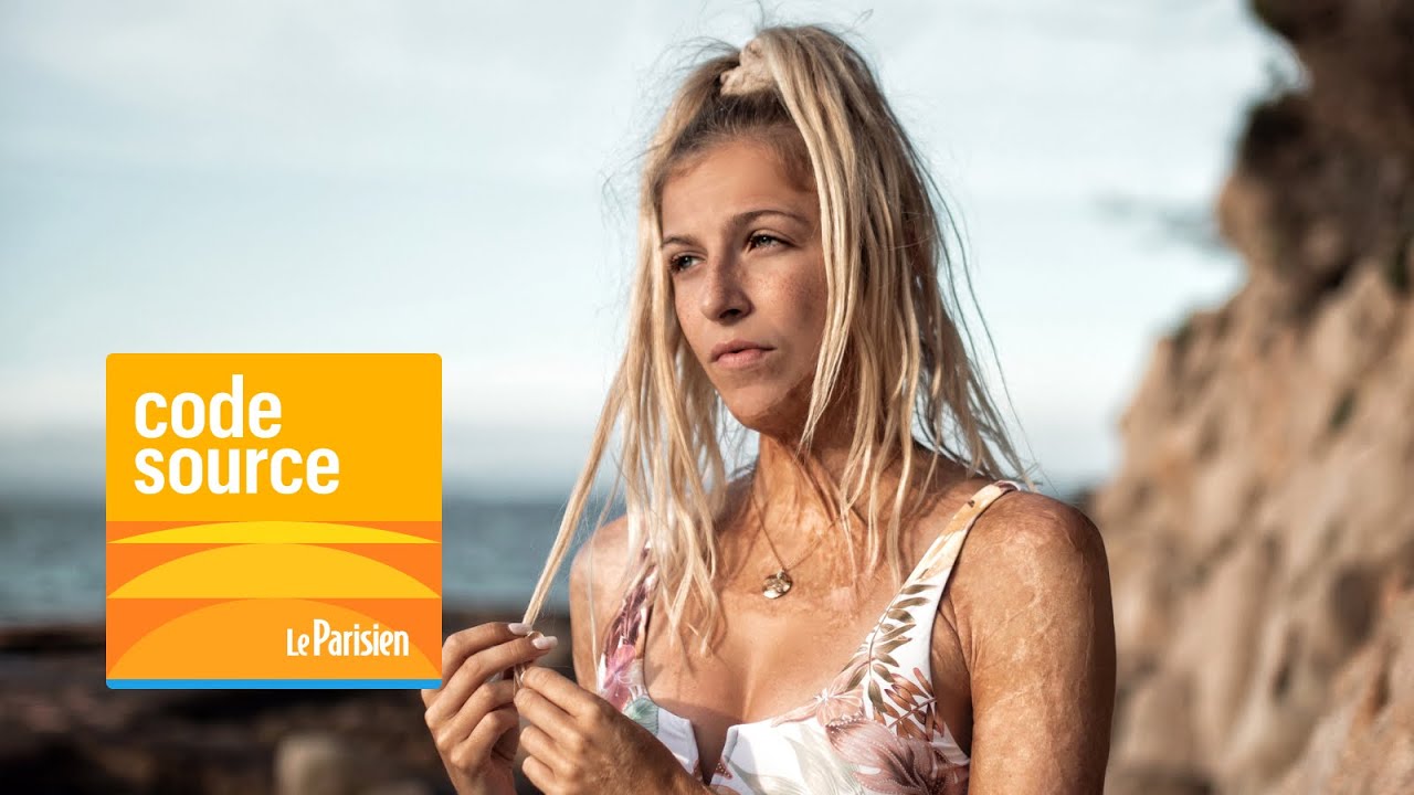 [PODCAST] Julie Bourges, grande brûlée, en guerre contre les complexes
