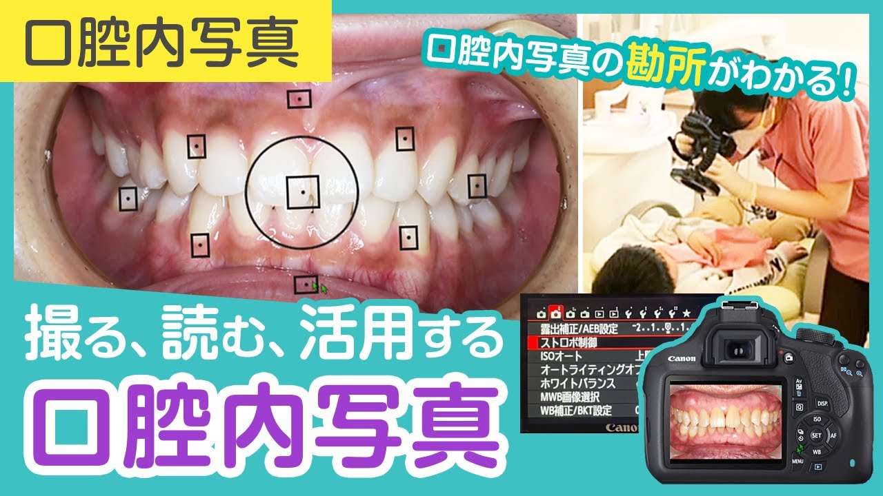 撮る、読む、活用する口腔内写真