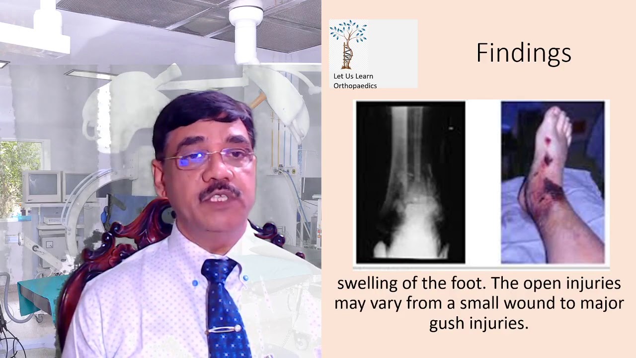 Let Us Learn Orthopaedics- Tibial Plafond Fractures Pilon Fractures