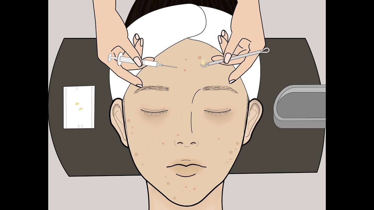 화장 스톱모션 2탄/피부관리 스킨케어/여드름 압출/메이크업 지우기 애니메이션/루루팡 설참