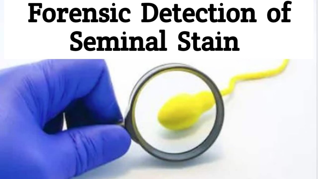 Forensic Detection of Seminal Stains|Different methods of Semen Detection|