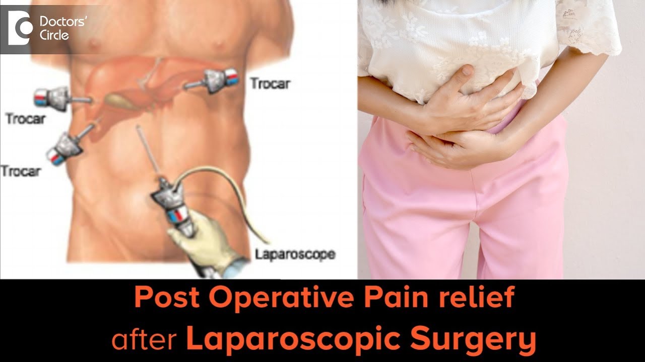 Manage  abdominal pain and gas after laparoscopic surgery - Dr. Nanda Rajaneesh
