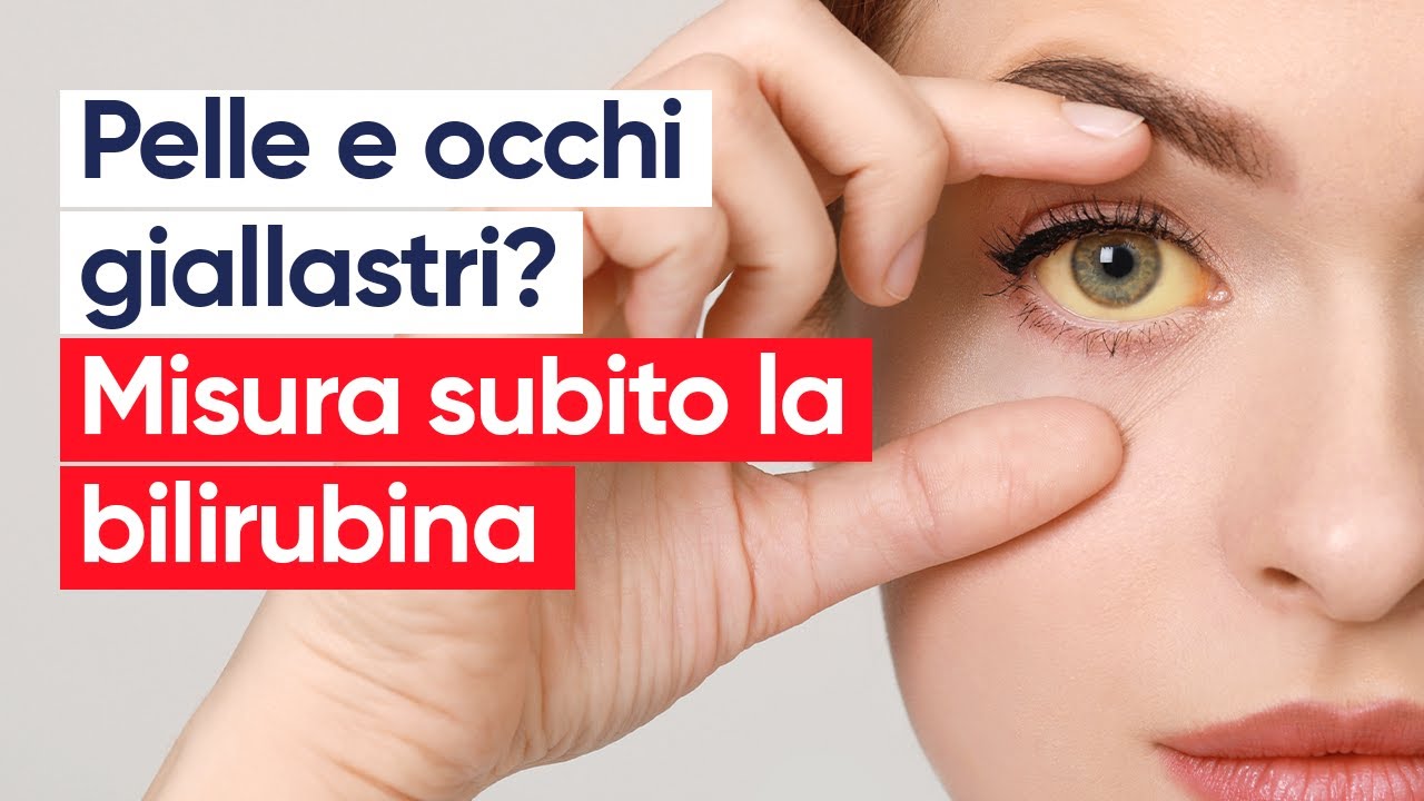 Bilirubina alta: quando preoccuparsi e quali sono le cause?