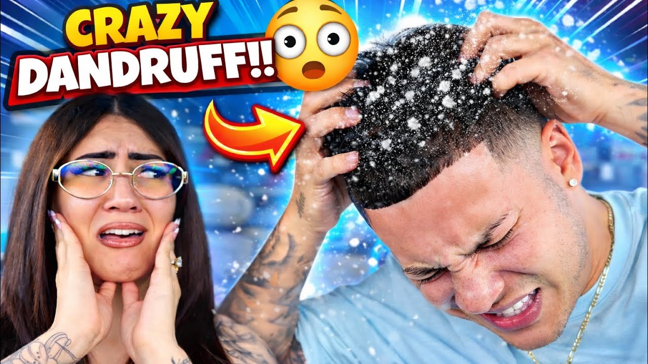 Устроим жене ужасную шутку с перхотью!! *она в ужасе*