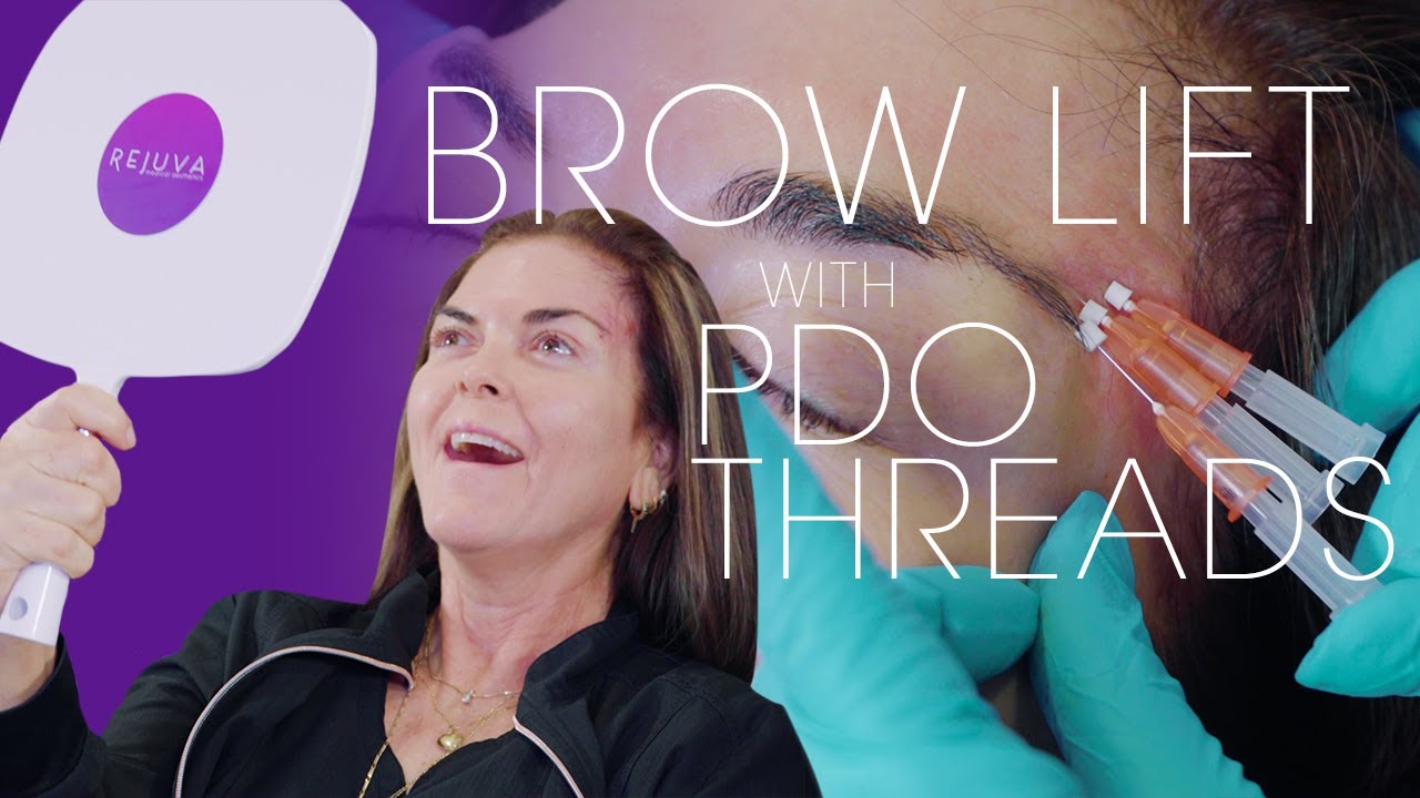 Brow Lift Using PDO Threads with Nurse Natalia