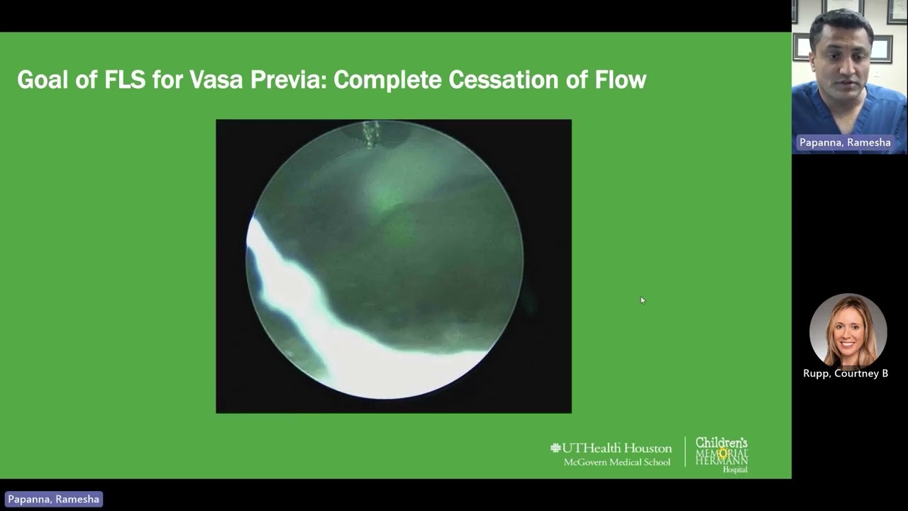 Fetoscopic Laser Ablation of Type II Vasa Previa