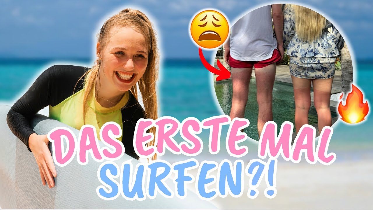 Schmerzhafter SONNENBRAND?!
