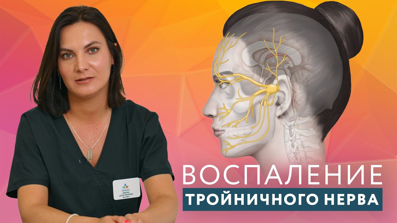 Невралгия тройничного нерва  // #zdravclinic