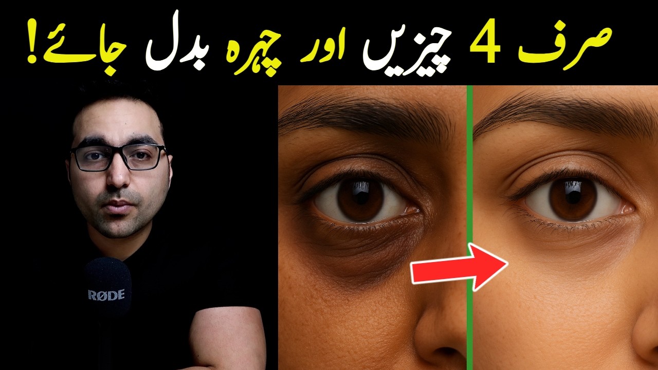 Aankhon ki soojan aur halqon se nijaat ka asaan hal | How to Get Rid of Puffy Eyes and Dark Circles