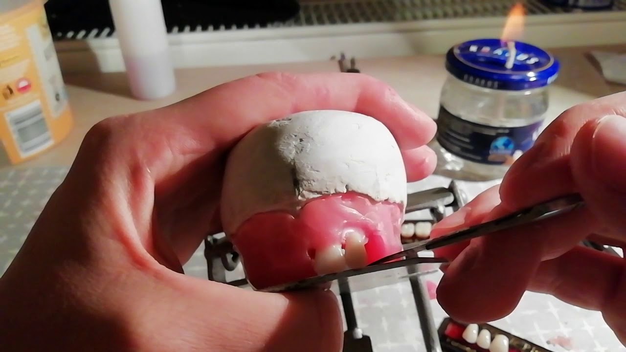 Technik dentystyczny - Ustawianie zębów metodą gysiego (zęby przednie)
