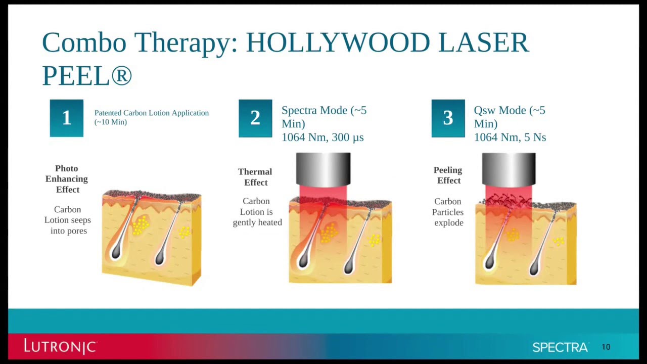 One Platform, All Patients, Year Round: Hollywood Laser Peel® & Pigment Treatments with Spectra™