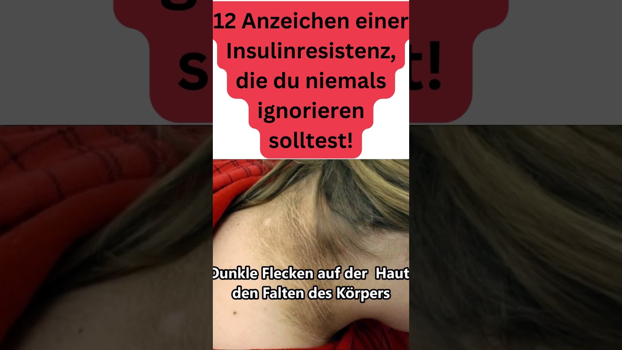 12 Anzeichen einer  Insulinresistenz, die du niemals ignorieren solltest! #kochenmitmaryam