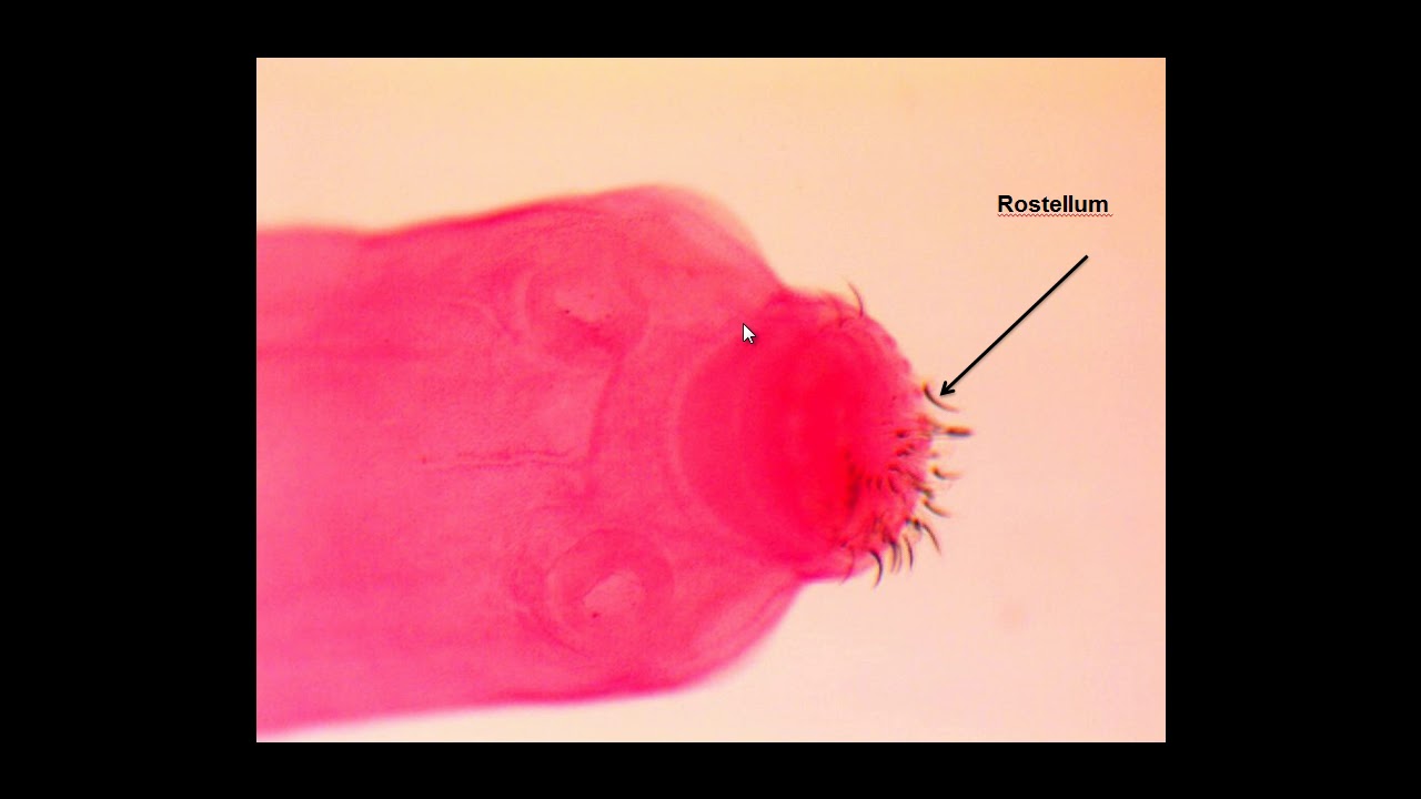 ORGANISM SLIDE Taenia pisiformis