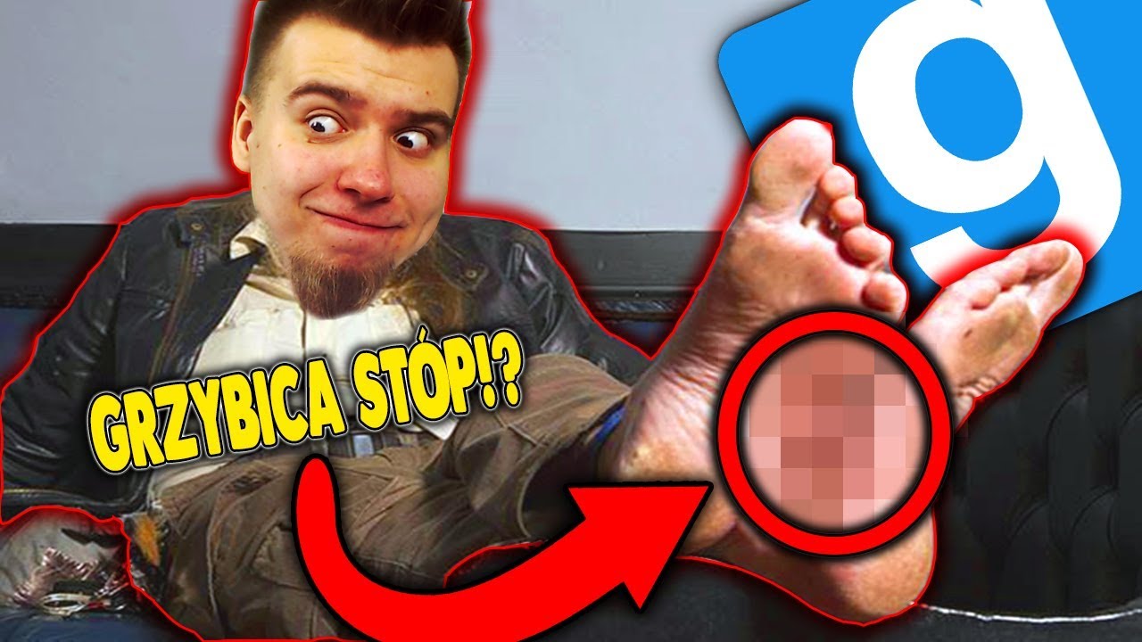 MANDZIO MA GRZYBICE STÓP!? || GARRY'S MOD (z: Mandzio, Bladii, Alien, Diabeuu)