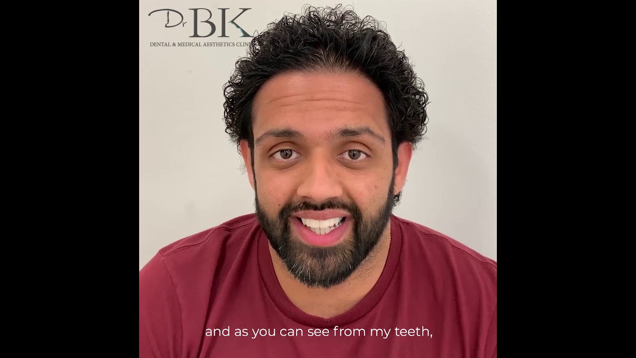 Avinash's Full Smile Makeover