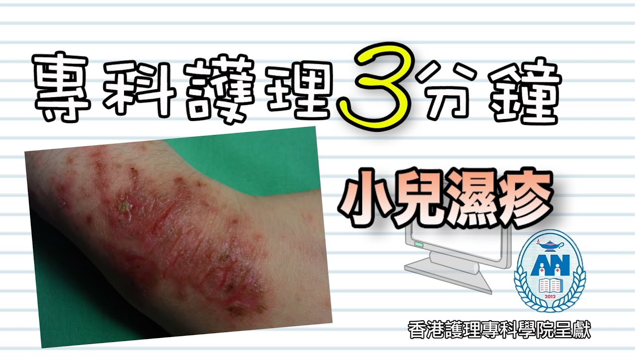 專科護理3分鐘(14) - 小兒濕疹