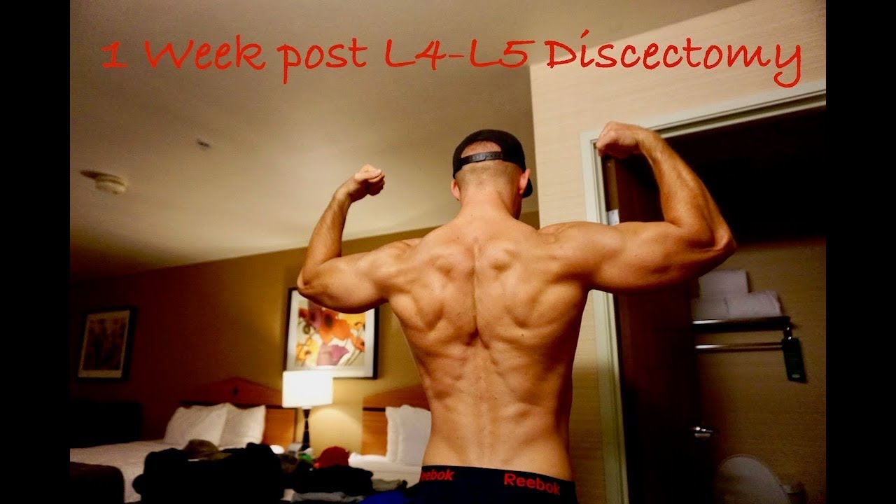 1 неделя после дискэктомии L4-L5