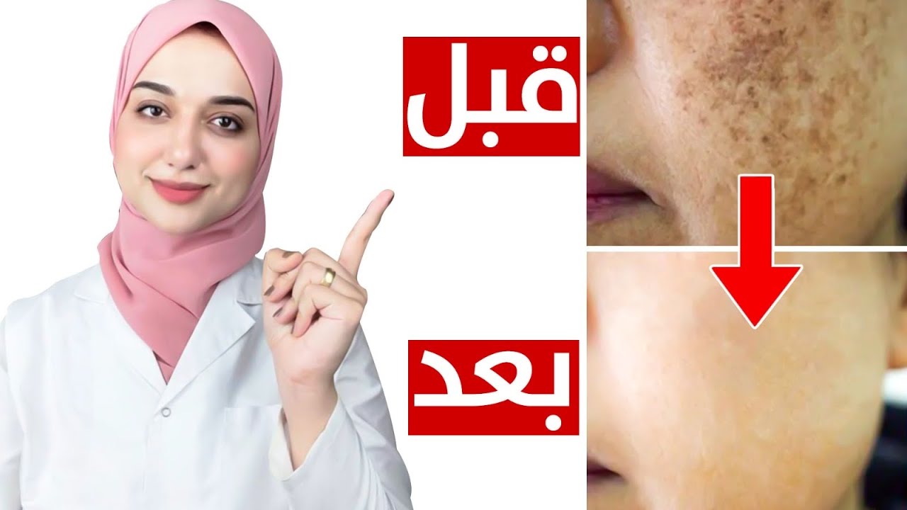 سر لتفتيح البشرة كالمشاهير/التركيبة السحرية لعلاج البقع الداكنةو التصبغات القديمةو الكلف/تبييض الوجه