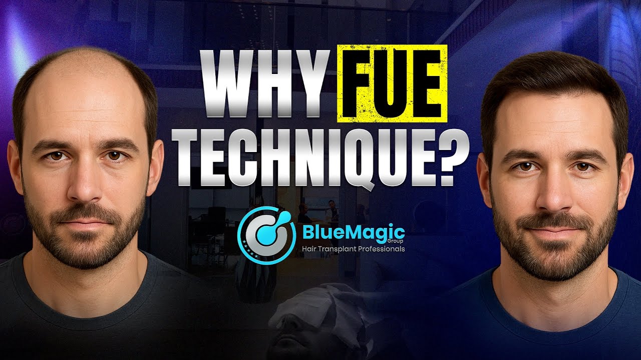 Является ли FUE наиболее распространенной техникой пересадки волос? | BlueMagic Group
