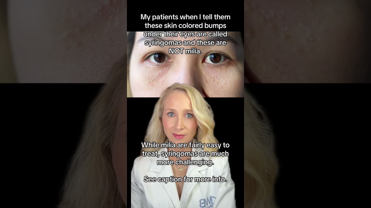 Derm Reacts to Skin Bumps | Milia or Syringoma? | 