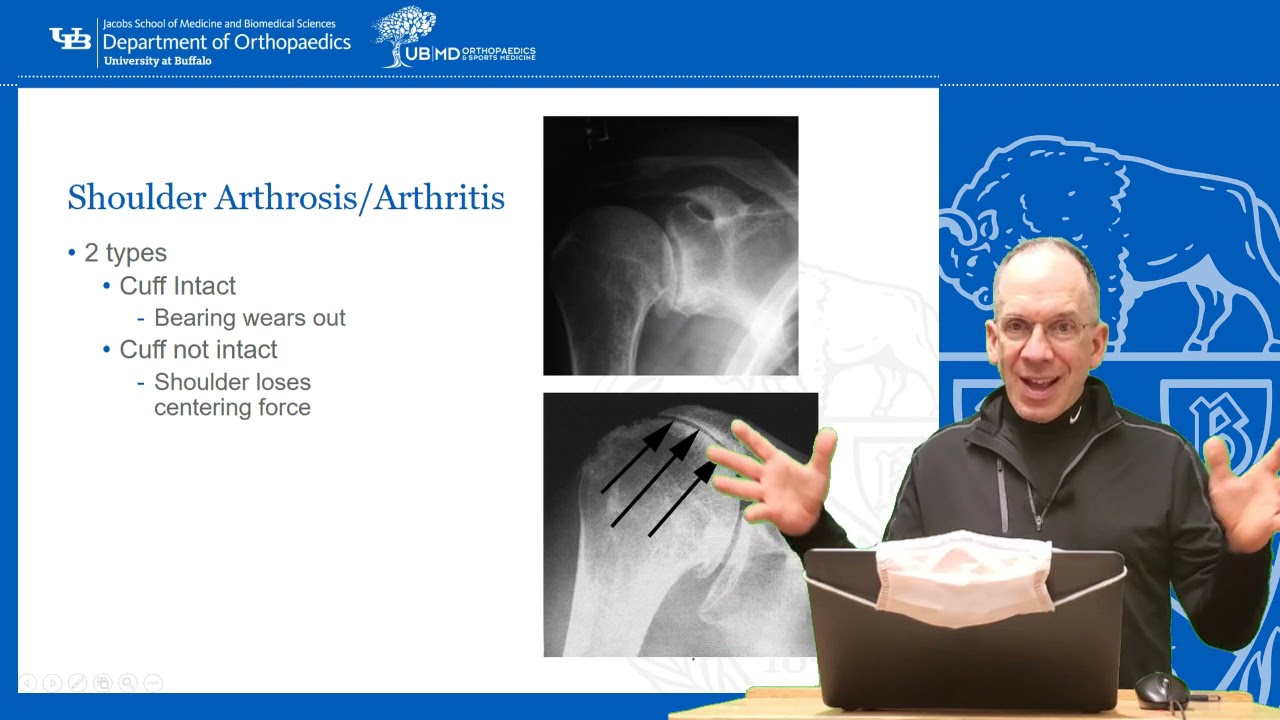 Neck Pain shoulder Pain