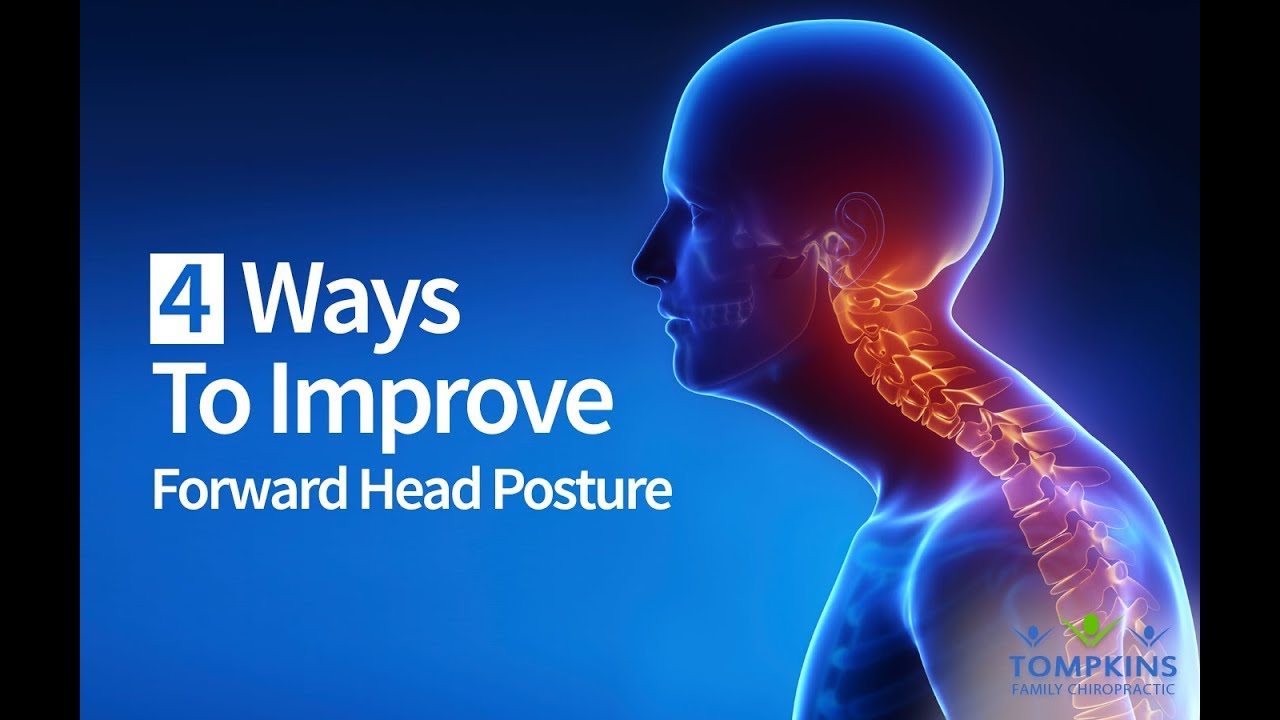 4 Ways To Reduce Forward Head Posture